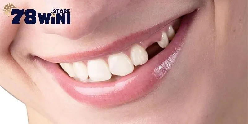 Mơ Thấy Rụng Răng - Điềm Báo Tương Lai Và Những Số Đề May Mắn 2 Sơ lược về giấc mơ thấy rụng răng